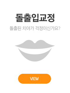 돌출입교정